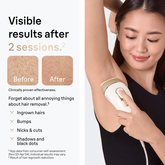 Braun Silk·expert Pro 5 IPL: Alternative to Laser Hair Removal with 2 Caps and Leather Pouch, PL5157 for Women | Quick Ship
