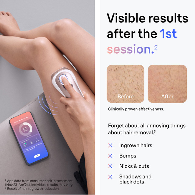 Braun Skin i·expert Smart IPL: At Home Alternative to Laser Hair Removal with 4 Caps and Vanity Case, PL7387 for Women | Quick Ship